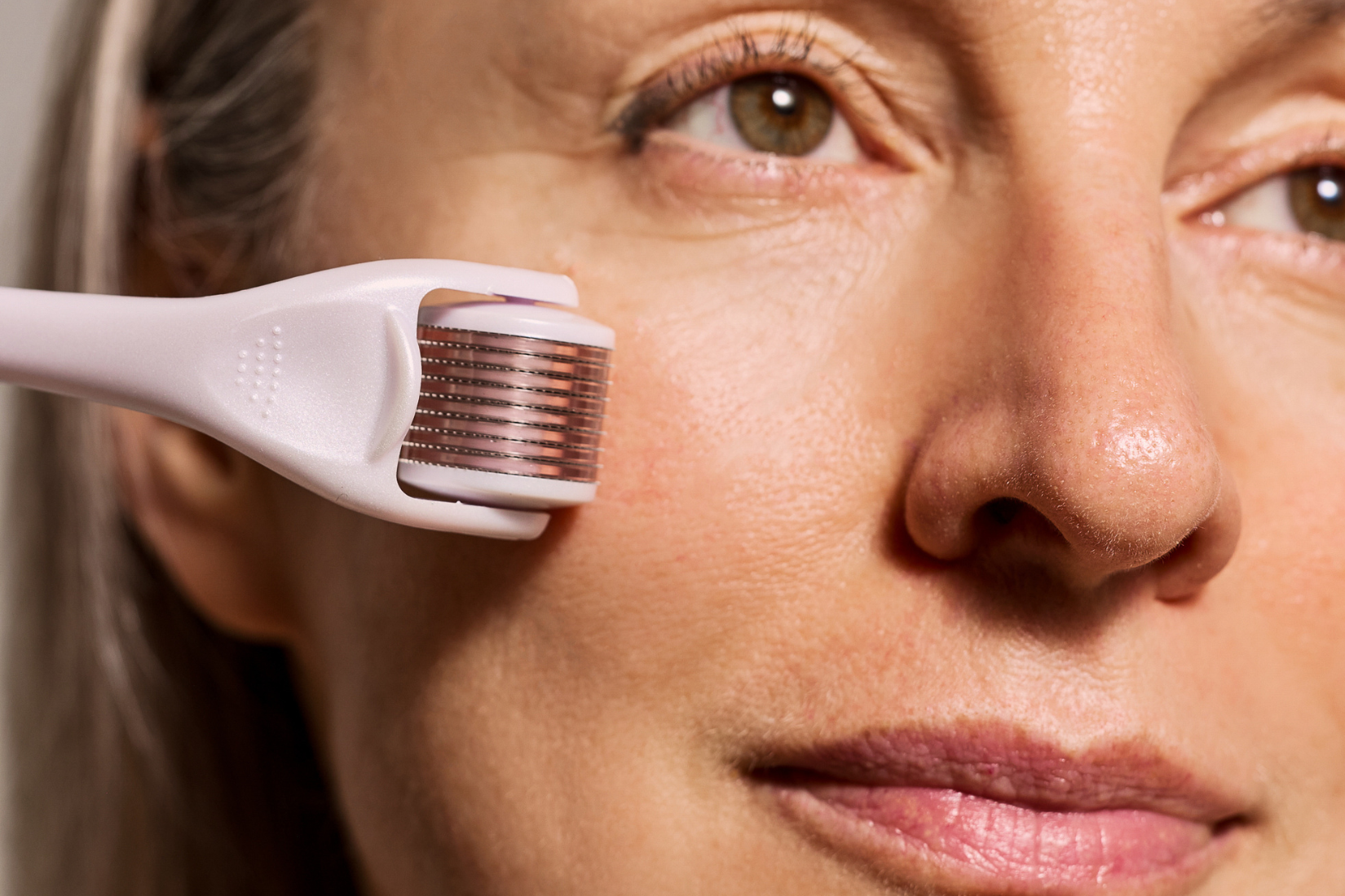 Microneedling