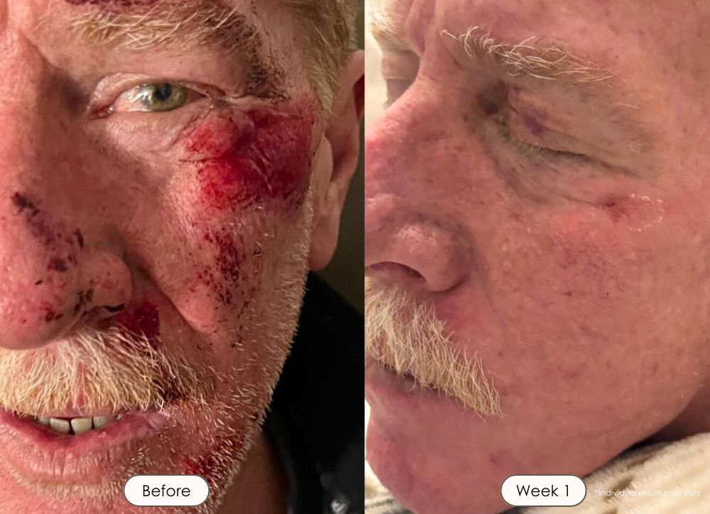 20250203-PE750-Before-and-After-Cherrie-Darling-Beauty-Dad-Mike