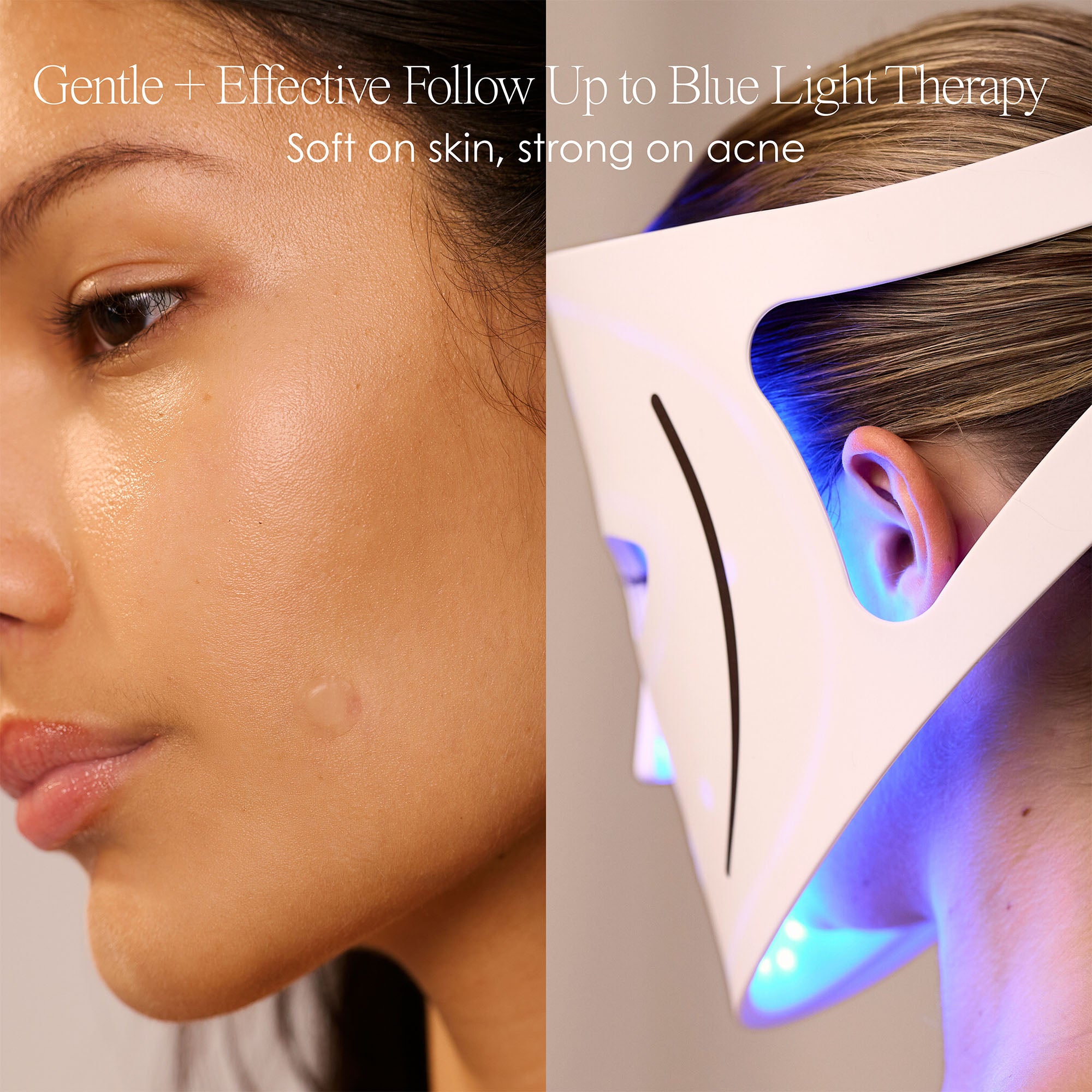 gentle and effective follow up to blue light therapy