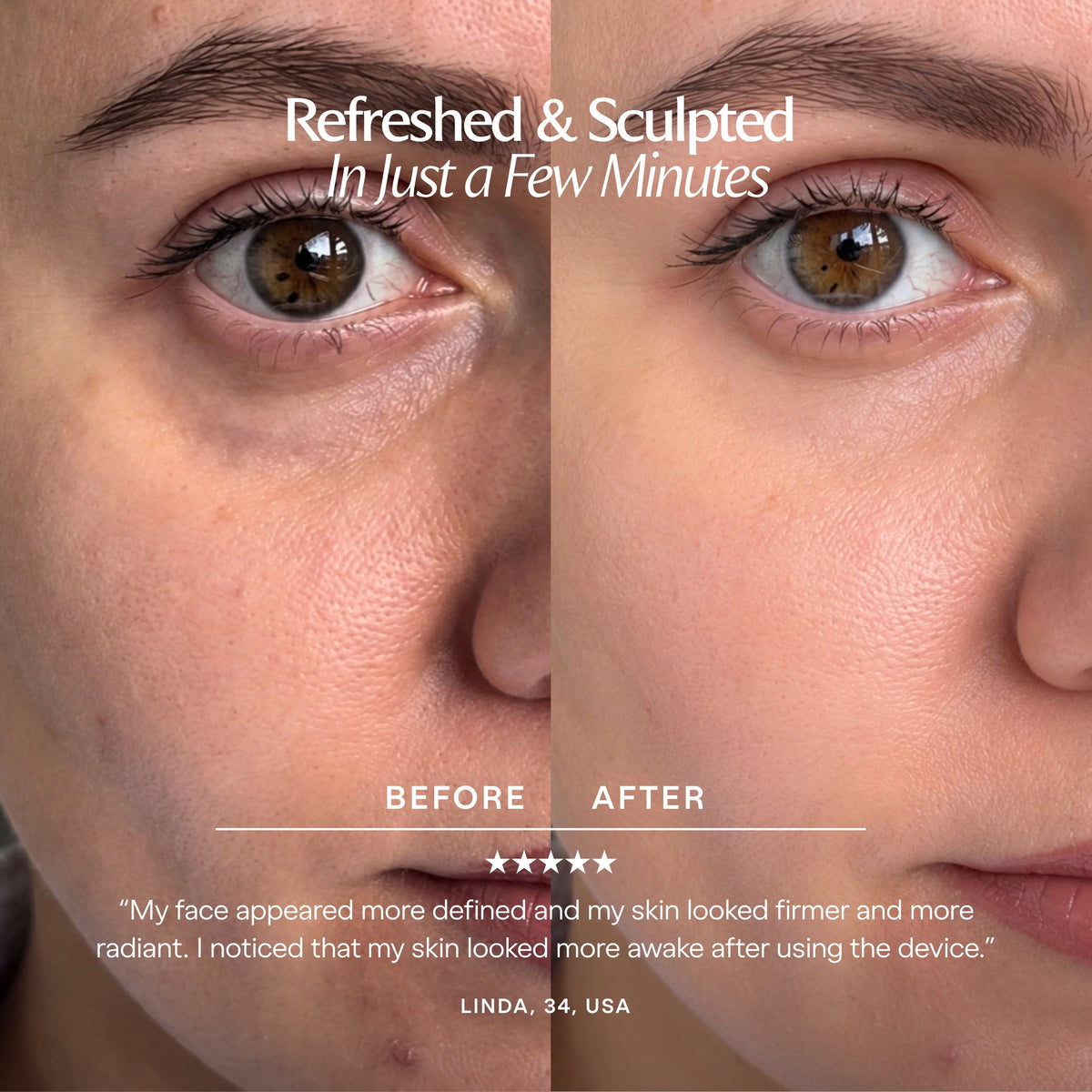 Cryo Ice Roller | Cold Therapy Sculpting Duo - Project E Beauty